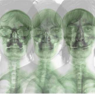 Supergrass