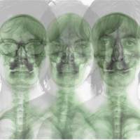 Supergrass