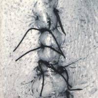 Infliction